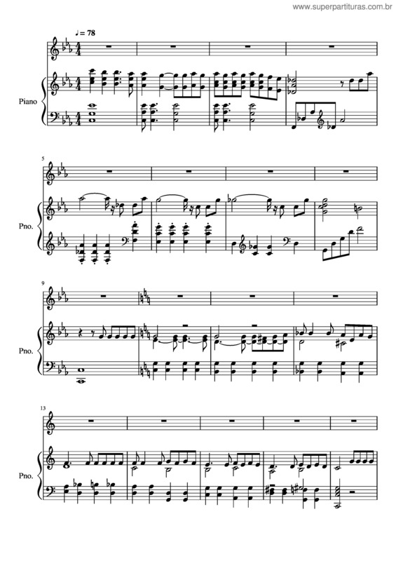 Partitura da música Balada Para Un Locosinvoz