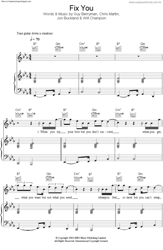 Partitura da música Fix You v.7
